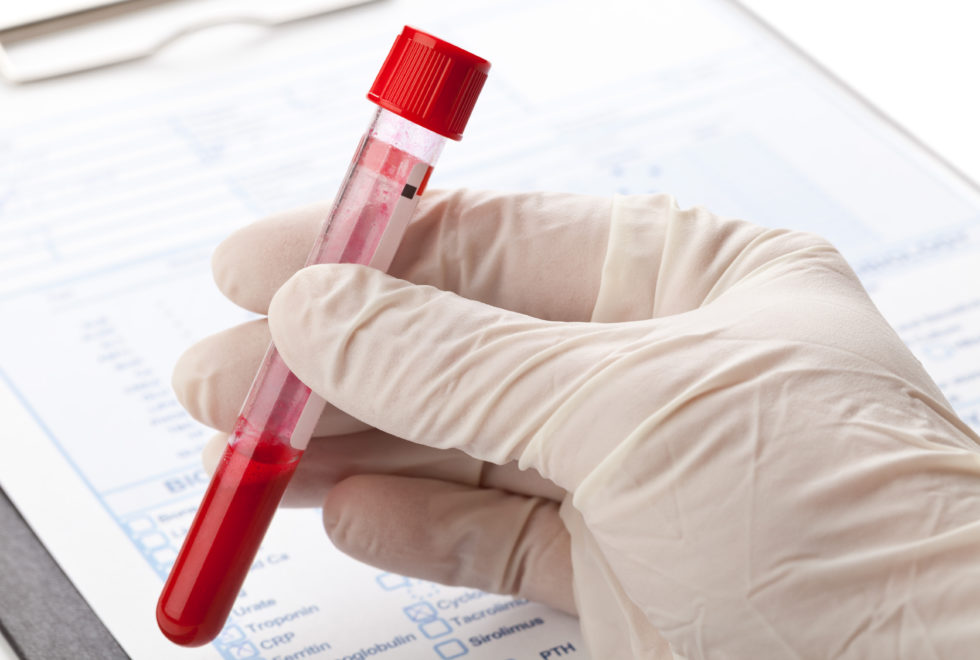 antibody-testing-clinic-11204